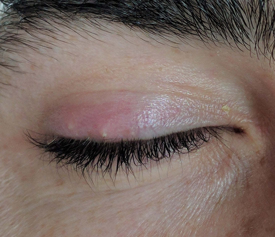 Illustration du guide Joly Beauty : Peut-on porter des faux cils quand on a un orgelet 